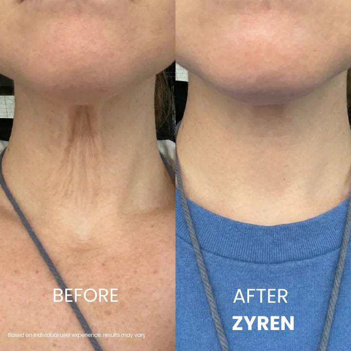 Zyren® Tighten & Lift Neck Cream
