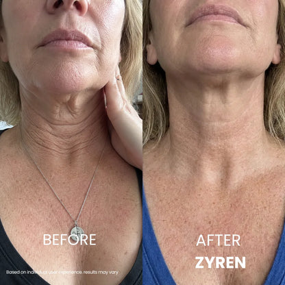 Zyren® Tighten & Lift Neck Cream