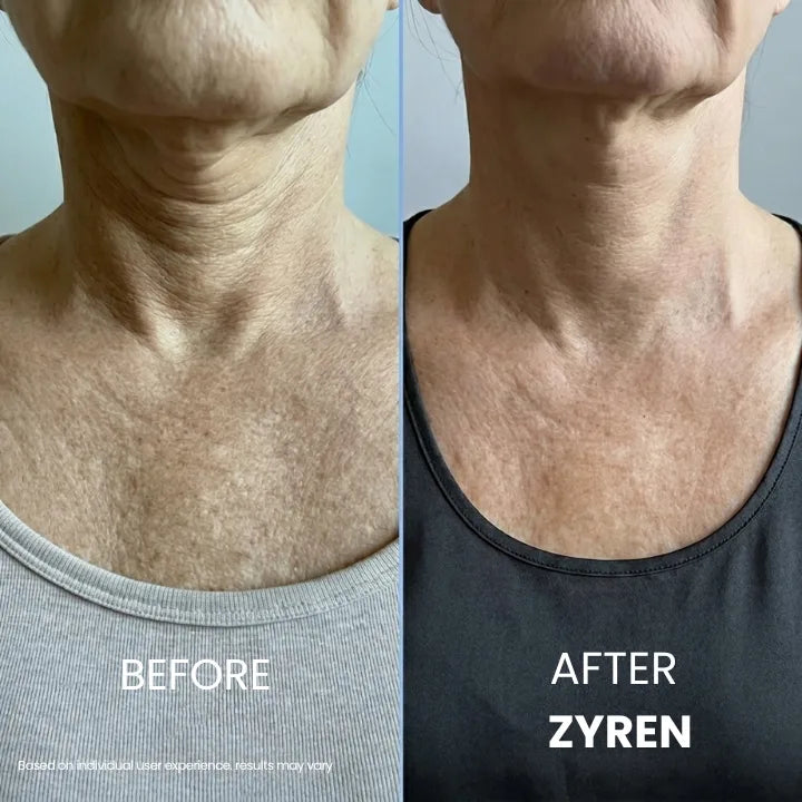 Zyren® Tighten & Lift Neck Cream